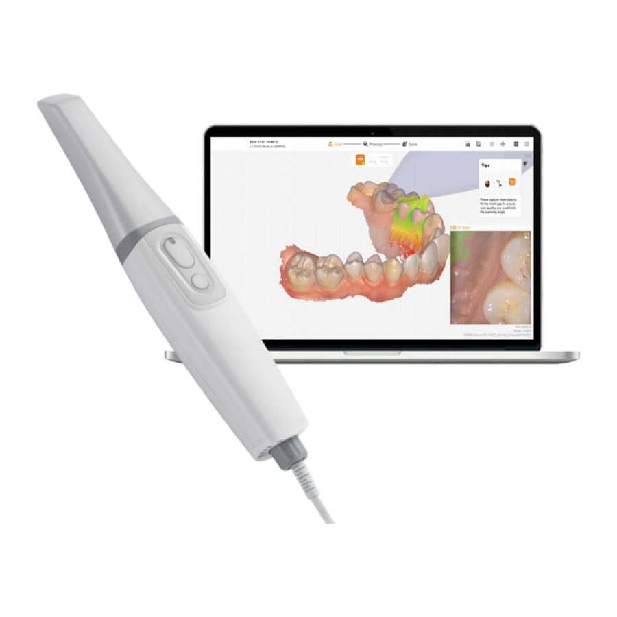Intraoral scanner SCAN-i5